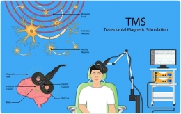 Transcranial Magnetic Stimulation (news-medical.net)