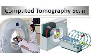 Penjelasan Computed Tomography (omegapds.com)