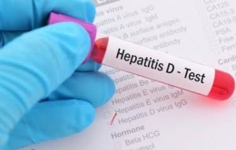 Foto ilustrasi alat tes Hepatitis D | (aset: kompas.com)