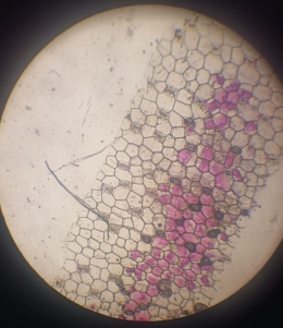 Sel mengalami plasmolisis. Sumber gambar : hasil pengamatan kelompok