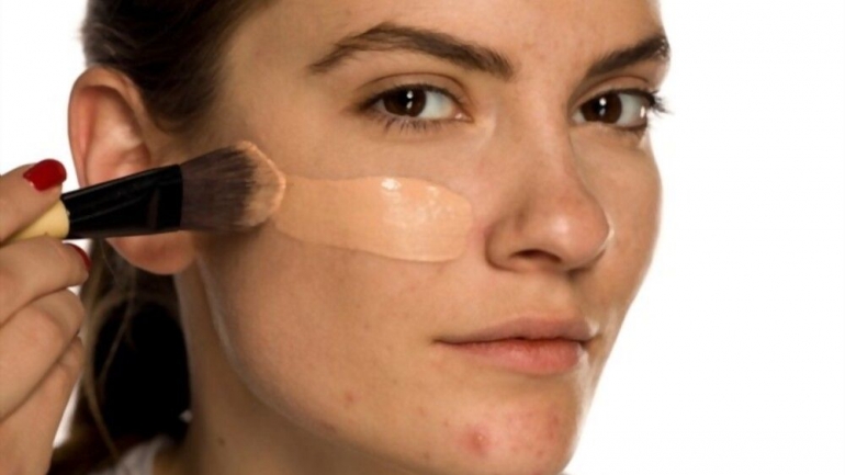 Ilustrasi makeup pada kulit berjerawat (Sumber: shutterstock)