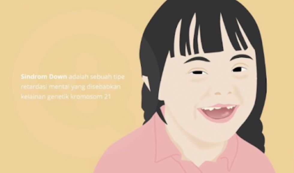 21 Maret Hari Down Syndrome, Dan Mengenal Apa Itu Down Syndrome ...