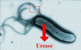 Helicobacter pylori di bawah mikroskop. Bagian yang menjuntai seperti kaki ubur-ubur (flagella) bergerak seperti baling-baling (bioweb.uwlax.edu).