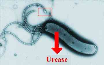 Helicobacter pylori di bawah mikroskop. Bagian yang menjuntai seperti kaki ubur-ubur (flagella) bergerak seperti baling-baling (bioweb.uwlax.edu).