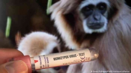 Image: Penularan virus monkeypox saat ini , utamanya bukan oleh monyet tetapi oleh kontak seksual (Sumber: WHO)