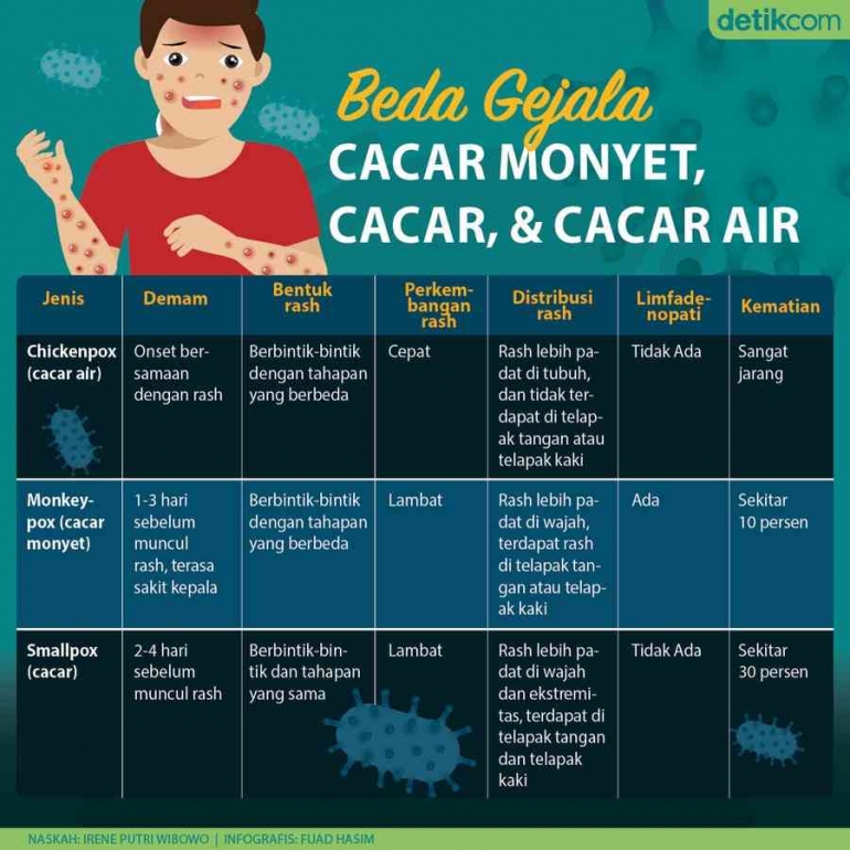 Beda cacar biasa dengan cacar monyet (detik)