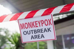 Investigasi global terhadap wabah monkeypox 2022 masih dalam tahap awal tim kesehatan masib belajar lebih banyak Foto: schitechdaily.com