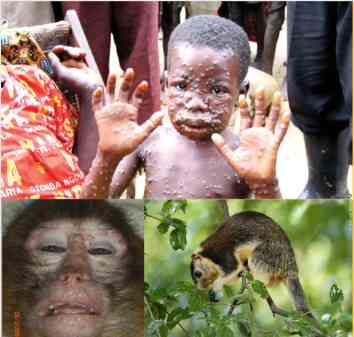  Monkeypox Jangan Salahkan Monyet: Foto p2p kemkes.go.id