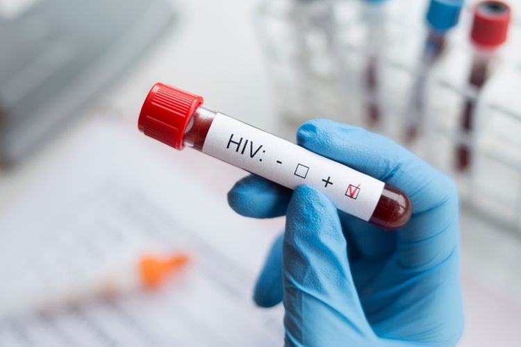 Ilustrasi virus HIV. Sumber: Shutterstock via Kompas.com