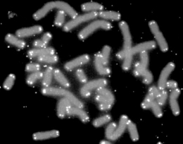 Kromosom manusia (abu-abu) dengan telomer (putih) di ujung-ujungnya. Memendeknya telomer bisa menyebabkan penuaan dini. (Wikimedia Common)