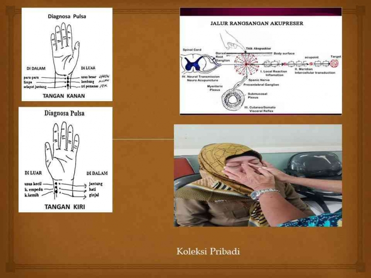 Mengenal Akupressure sebagai Pengobatan Holistik