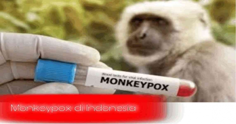 Ilustrasi Penyakit Cacar Monyet (Monkey Pox) di Indonesia (Source: CNN Indonesia)
