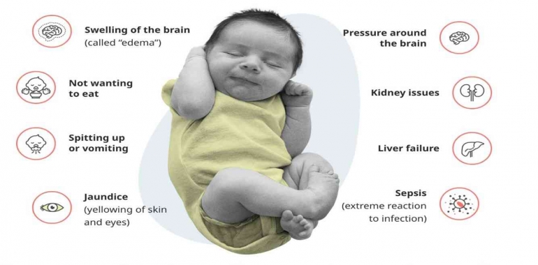 Gejala-gejala galaktosemia | sumber foto: galactosemia.com