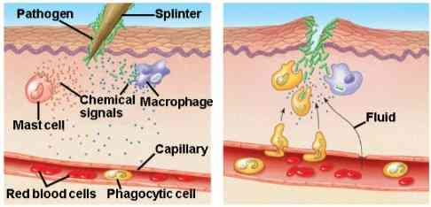 Si Biru dari Maluku dan Potensinya sebagai Anti Inflamasi 3 Gambar 2 Respon inflamasi menyebabkan pembengkakan (Campbell & Reece 2008).