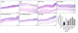 Gambar 2 Efek probiotik dan sinbiotik pada sel goblet penghasil mukus yang diinduksi dengan DSS dilihat dari mikroskop (Kangwan et al. 2020).