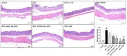 Gambar 1 Efek probiotik dan sinbiotik dalam mengurangi kerusakan usus besar yang diberikan DSS dilihat dengan mikroskop cahaya (Kangwan et al. 2020).