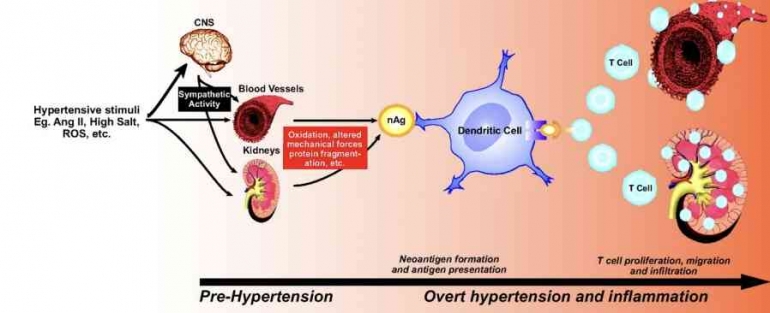 Gambar 2.  Peran sel T dan inflamasi terhadap kejadian hipertensi (Lim 2019).