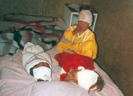 Photo of Children wounded by American airstrikes in Afghanistan's Surkh-Rōd District in 2001, RAWA reporter.