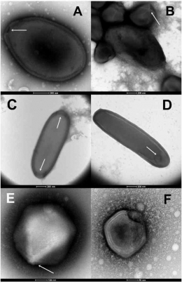 Gambar 3.  Virus yang ditemukan di bawah Permafrost (A. Partikel bulat telur besar (panjang 1.000 nm) Pandoravirus; B. Campuran partikel Pandoravirus 