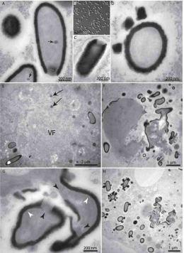 Gambar 5.  Pencitraan mikroskop elektron partikel Pithovirus dan sel Acanthamoeba yang terinfeksi