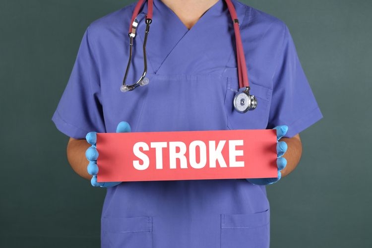 Ilustrasi kenali gejala stroke dan cara menghadapinya. Sumber: Shutterstock via Kompas.com