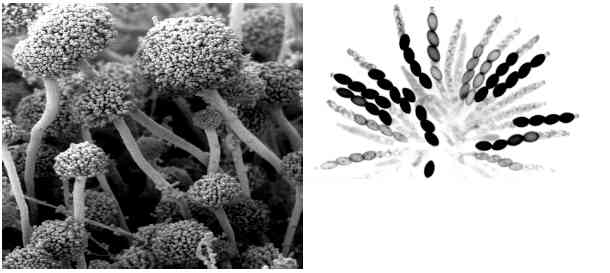 Pencitraan mikroskop dari kiri ke kanan: a) Rhizopus oligosporus; b) Neurospora sitophila. Sumber : via Desanto, 2013