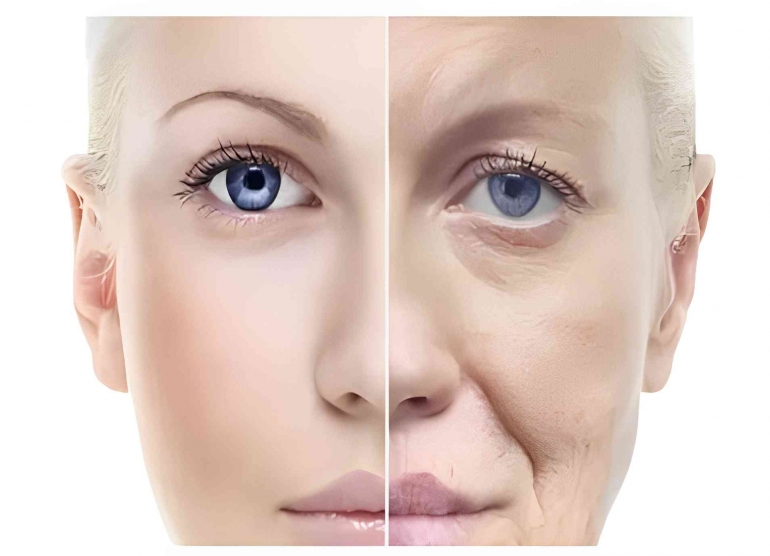 ilustrasi wajah yang mengalami penuaan (URBANJABAR.COM)