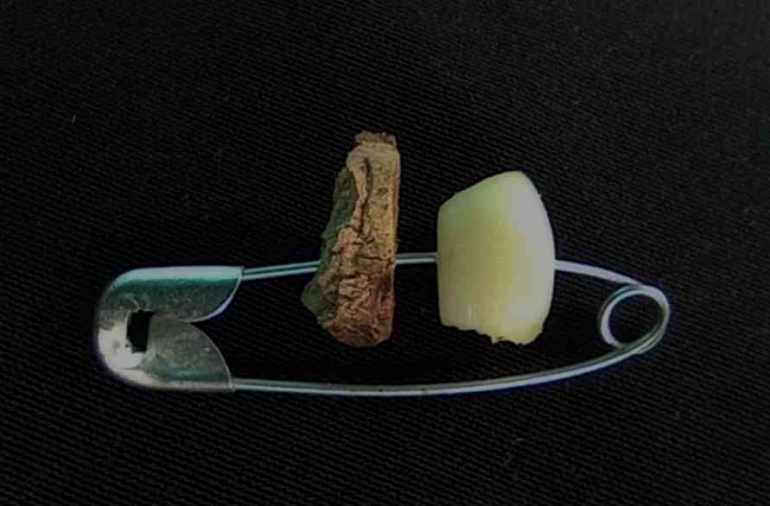 Potongan rimpang genoak dan bawang putih dalam peniti sebagai penangkal suanggi . Gambar: dokumentasi Imanuel Lopis.
