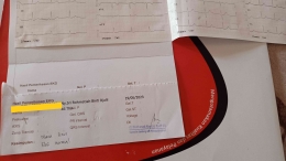 Foto dokumentasi pribadi hasil EKG