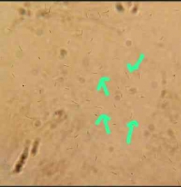 Bakteri Bacillus velezensis (perbesaran 400x) Foto dokumentasi : Dr. Ika R. Layly