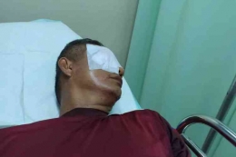 Contoh kekerasan pada pendidik. Guru Zaharman di Rejang Lebong, Bengkulu, bola matanya hancur karena dikatapel orangtua murid. (KOMPAS.com/Firmansyah)