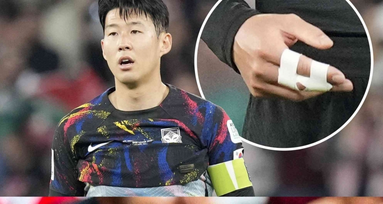 Penampakan jari tangan Son Heung-min yang diperban. sumber : www.harian.disway.id