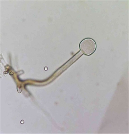 Morfologi mikroskopi kapang Rhizopus. Dokumentasi pribadi dari kapang Rhizopus pada saat saya membuat laru tempe
