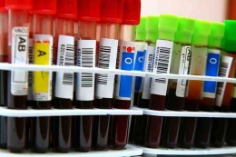 Sumber gambar: Golongan Darah A, B, AB, dan O, Ketahui Masing-Masing Karakteristiknya - Alodokter 