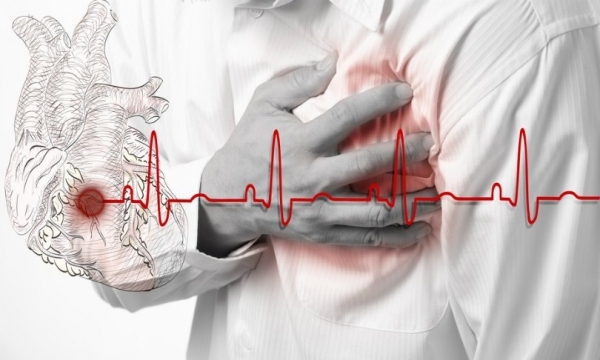 Ilustrasi serangan jantung. Sumber: Shutterstock/Kladej