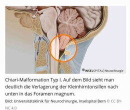 www.neurochirurgie.insel.ch