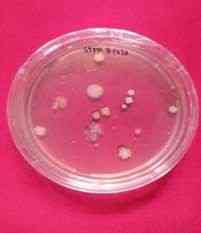 Microbe growth after isolation (dokpri Endriani, 2022)