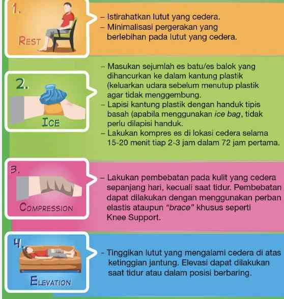 (Arti singkatan R.I.C.E(https://globalinti.com/))