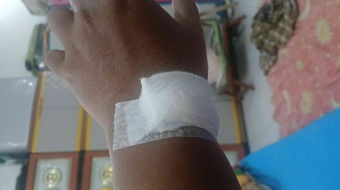 Infus omjay sdh dilepas/dokpei