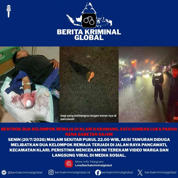 Viral! Bentrokan dua remaja di Klari Karawang, satu korban alami luka parah di tangan diduga akibat senjata tajam. Polisi masih selidiki.