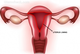 Lapisan rahim bagian dalam (warna merah) adalah bagian rahim yang meluruh saat menstruasi. (Diambil dari : http://cdn.glamcheck.com/health/files/2011/07/Menstruation-uterus-lining.jpg)