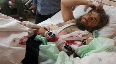Abu Muhammad salah seorang Tokoh ISIS yang di rawat dirumah Sakit Istambul Turkey