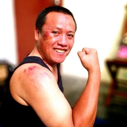 Rambo terluka jatuh dari sepeda di Nanggulan