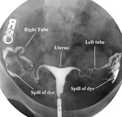 Image result for hsg yang normAL