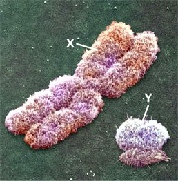 <b>Gambar</b> menunjukan model <b>kromosom</b> <b>X</b> <b>dan</b> <b>kromosom</b> <b>Y</b> yang ada pada sel ...